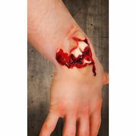 cicatrice en latex - Fracture ouverte du poignet